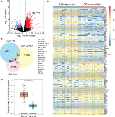 OXCT1 Enhances Gemcitabine Resistance Through NF-κB Pathway in Pancreatic Ductal Adenocarcinoma